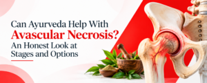 Ayurvedic Care for AVN